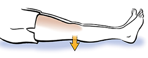 Leg from knee down showing quadriceps sets.